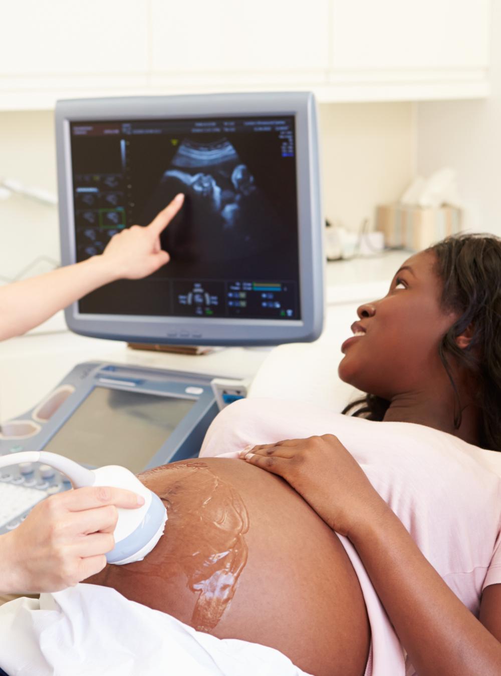 Clinician conducting an ultrasound for a pregnant woman