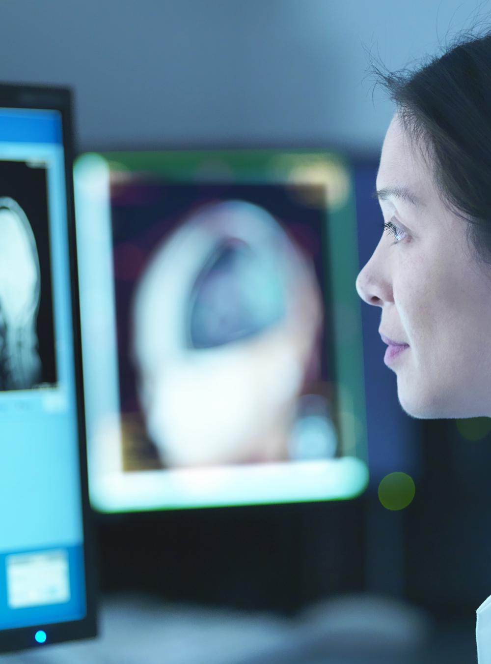 Woman in lab coat viewing MRI images on a computer screen