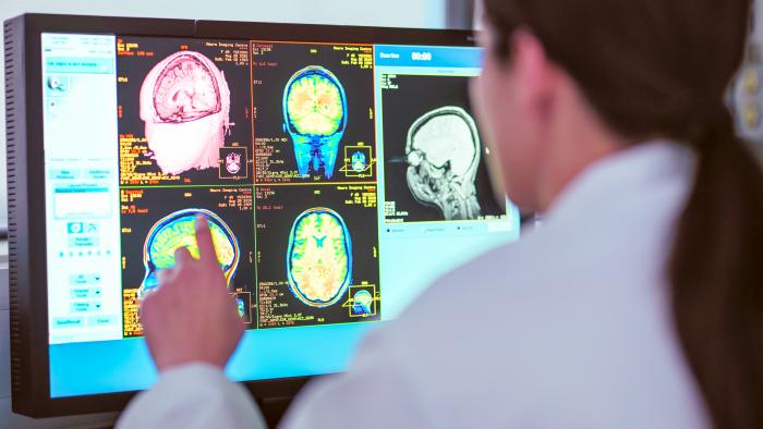 Doctor looking at MRI scanner monitor